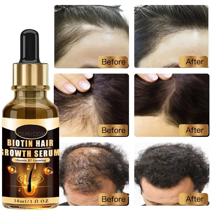 Biotin Hair Growth Serum - Vitamin B7 Anti Hair Loss Treatment for Thicker, Stronger Hair